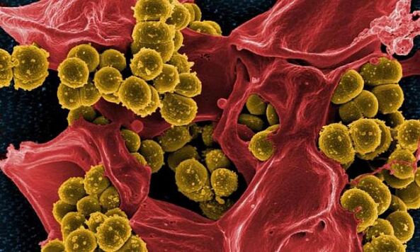 Staphylococcus aureus bakteria prostatitisaren kausa gisa