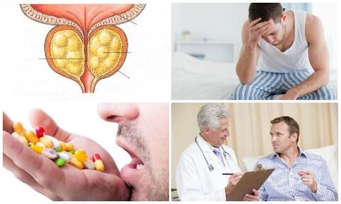 prostatitisa gizonezkoetan